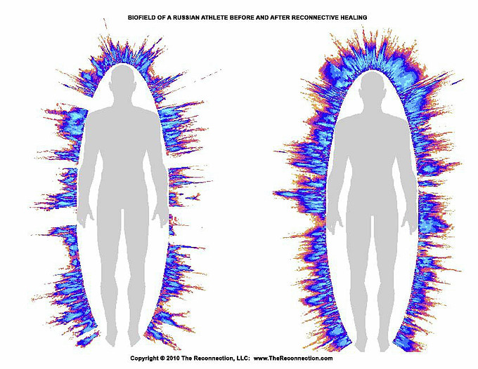 Biopole ruského atleta před a po rekonektivním léčení - převzato ze studie Konstantina Korotkova